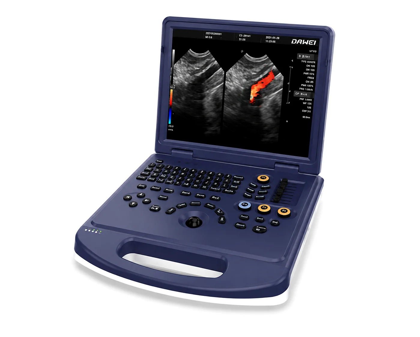 USG Dawei L30i Vet